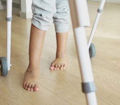 Discrepanza nella lunghezza delle gambe: comprendere lo squilibrio, riconoscere il danno e trovar...