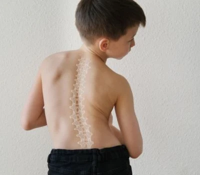 Il tempo trascorso davanti allo schermo sta rimodellando la spina dorsale di una generazione?