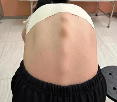 Rivoluzionare la salute della colonna vertebrale: Xianku 3D Body Scanner