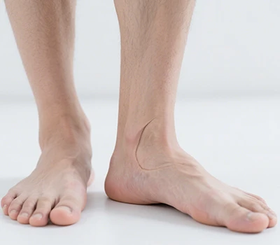 L'epidemia silenziosa: come gli archi caduti minacciano la salute globale e la rivoluzione tecnol...