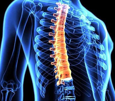 Correzione spinale: come lo scanner del corpo Xianku3D sta trasformando l'assistenza sanitaria sp...