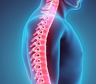 Correzione spinale: soluzione per colonna vertebrale digitale-esente da radiazioni